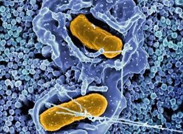 Resistencia antimicrobiana